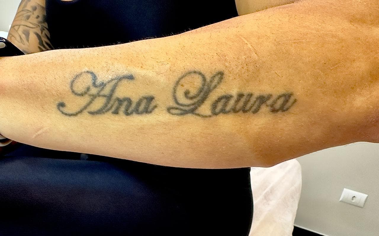Antes — Nome no antebraço em processo de clareamento